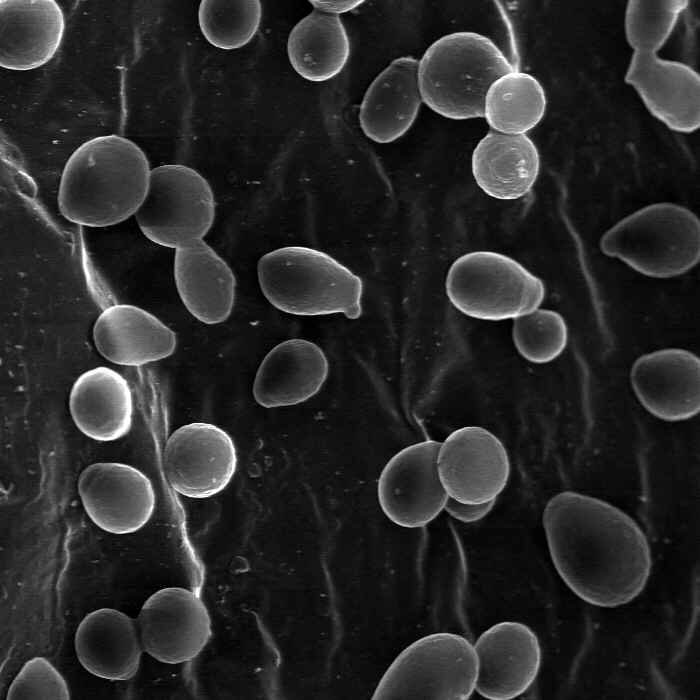 Yeast